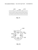 TERMINATION OF A SHIELD WITHIN AN IMPLANTABLE MEDICAL LEAD diagram and image