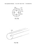 TERMINATION OF A SHIELD WITHIN AN IMPLANTABLE MEDICAL LEAD diagram and image