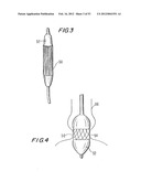 PROSTHETIC VALVE FOR CATHETER DELIVERY diagram and image