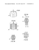 PROSTHETIC VALVE FOR CATHETER DELIVERY diagram and image