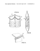 PROSTHETIC VALVE FOR CATHETER DELIVERY diagram and image