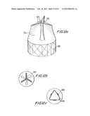 PROSTHETIC VALVE FOR CATHETER DELIVERY diagram and image