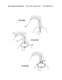 PROSTHETIC VALVE FOR CATHETER DELIVERY diagram and image