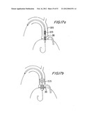 PROSTHETIC VALVE FOR CATHETER DELIVERY diagram and image