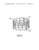 PROSTHETIC VALVE FOR CATHETER DELIVERY diagram and image