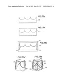 PROSTHETIC VALVE FOR CATHETER DELIVERY diagram and image