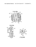 PROSTHETIC VALVE FOR CATHETER DELIVERY diagram and image