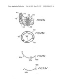 PROSTHETIC VALVE FOR CATHETER DELIVERY diagram and image