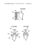 PROSTHETIC VALVE FOR CATHETER DELIVERY diagram and image