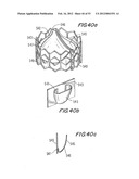 PROSTHETIC VALVE FOR CATHETER DELIVERY diagram and image