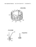 PROSTHETIC VALVE FOR CATHETER DELIVERY diagram and image