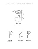 PROSTHETIC VALVE FOR CATHETER DELIVERY diagram and image