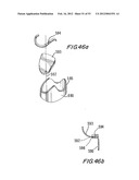 PROSTHETIC VALVE FOR CATHETER DELIVERY diagram and image