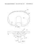 ORTHOPAEDIC IMPLANTS AND METHODS diagram and image