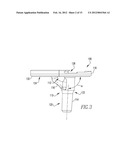 ORTHOPAEDIC IMPLANTS AND METHODS diagram and image