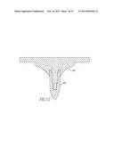 ORTHOPAEDIC IMPLANTS AND METHODS diagram and image