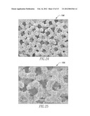 ORTHOPAEDIC IMPLANTS AND METHODS diagram and image