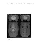 LOW DOSE SINGLE STEP GRATING BASED X-RAY PHASE CONTRAST IMAGING diagram and image