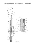 Length Adjustable Member diagram and image