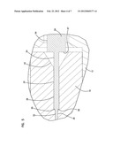 DUAL INNER DIAMETER FERRULE DEVICE AND METHOD diagram and image