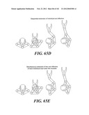 Dual Arm Robot diagram and image