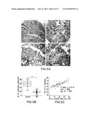 MicroRNAs In Idiopathic Pulmonary Fibrosis diagram and image