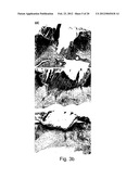 PHARMACEUTICAL PREPARATION COMPRISING SUPERNATANT OF BLOOD MONONUCLEAR     CELL CULTURE diagram and image