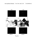 PHARMACEUTICAL PREPARATION COMPRISING SUPERNATANT OF BLOOD MONONUCLEAR     CELL CULTURE diagram and image