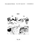 PHARMACEUTICAL PREPARATION COMPRISING SUPERNATANT OF BLOOD MONONUCLEAR     CELL CULTURE diagram and image