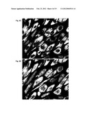 ANTI-CANCER MICROPARTICLE diagram and image