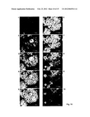 ANTI-CANCER MICROPARTICLE diagram and image