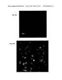 ANTI-CANCER MICROPARTICLE diagram and image