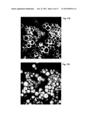 ANTI-CANCER MICROPARTICLE diagram and image