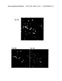 ANTI-CANCER MICROPARTICLE diagram and image