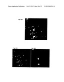 ANTI-CANCER MICROPARTICLE diagram and image