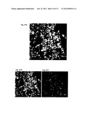 ANTI-CANCER MICROPARTICLE diagram and image