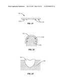 IMPLANT REPAIR SYSTEM AND METHOD diagram and image