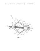 ANCHORING IMPLANT diagram and image