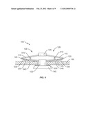 ANCHORING IMPLANT diagram and image