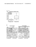 JARID1B FOR TARGET GENE OF CANCER THERAPY AND DIAGNOSIS diagram and image