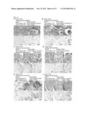 JARID1B FOR TARGET GENE OF CANCER THERAPY AND DIAGNOSIS diagram and image