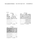 JARID1B FOR TARGET GENE OF CANCER THERAPY AND DIAGNOSIS diagram and image