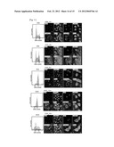 JARID1B FOR TARGET GENE OF CANCER THERAPY AND DIAGNOSIS diagram and image