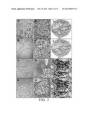 DETECTING BCL-B EXPRESSION IN CANCER AND USES THEREOF diagram and image