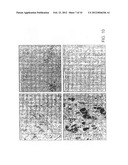 METHODS FOR TREATING OSTEOCLAST-RELATED DISEASE, COMPOUNDS AND     COMPOSITIONS THEREOF diagram and image