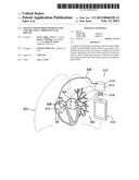 SYSTEM AND METHOD FOR DETECTING AND TREATING CARDIOVASCULAR DISEASE diagram and image