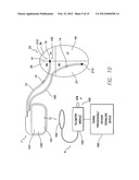 SYSTEM AND METHOD FOR DETECTING AND TREATING CARDIOVASCULAR DISEASE diagram and image