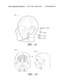 SYSTEM AND METHOD FOR COSMETIC TREATMENT diagram and image