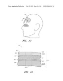 SYSTEM AND METHOD FOR COSMETIC TREATMENT diagram and image