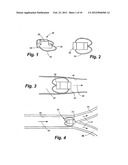 APPARATUS AND METHOD FOR SENSOR DEPLOYMENT AND FIXATION diagram and image